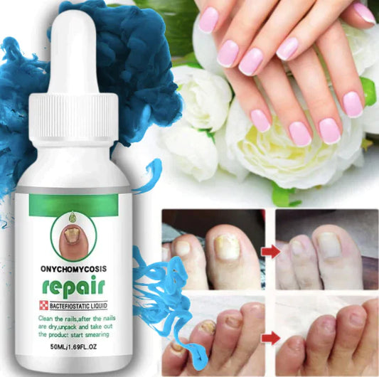 Nail Serum for Nail Growth & Repair, Fungal Infection, Anti-infective Removal